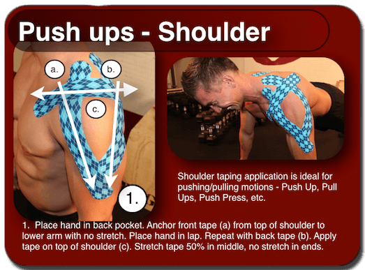 RockTape Brookvale RockTape for Shoulder Pain Brookvale Manly Northern Beaches